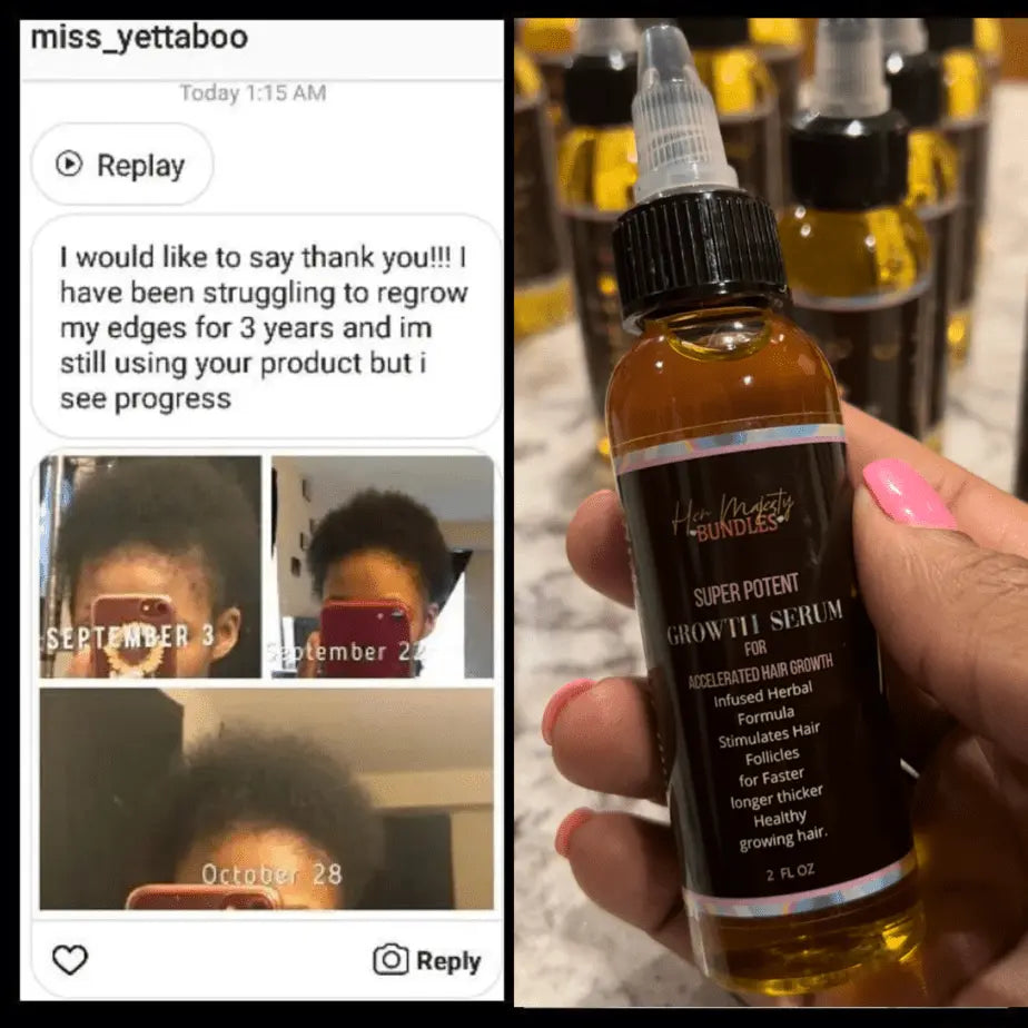 Super potent Hair Growth oil- For Accelerated hair growth - Her Majesty Bundles